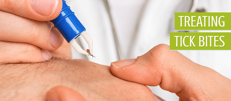 doctor removing a tick from a person
