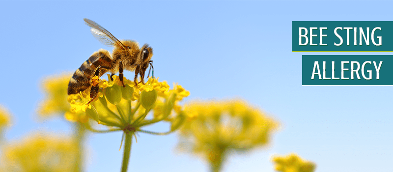 treat a bee sting allergy
